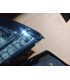 HG PILOTOS SEAT LEON 1P 04-09 LED FONDO NEGRO R145431C2